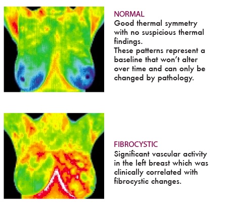 thermo1